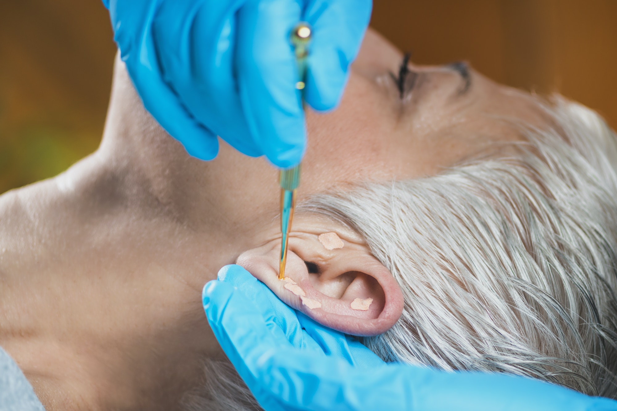 Ear Acupuncture Point Therapy